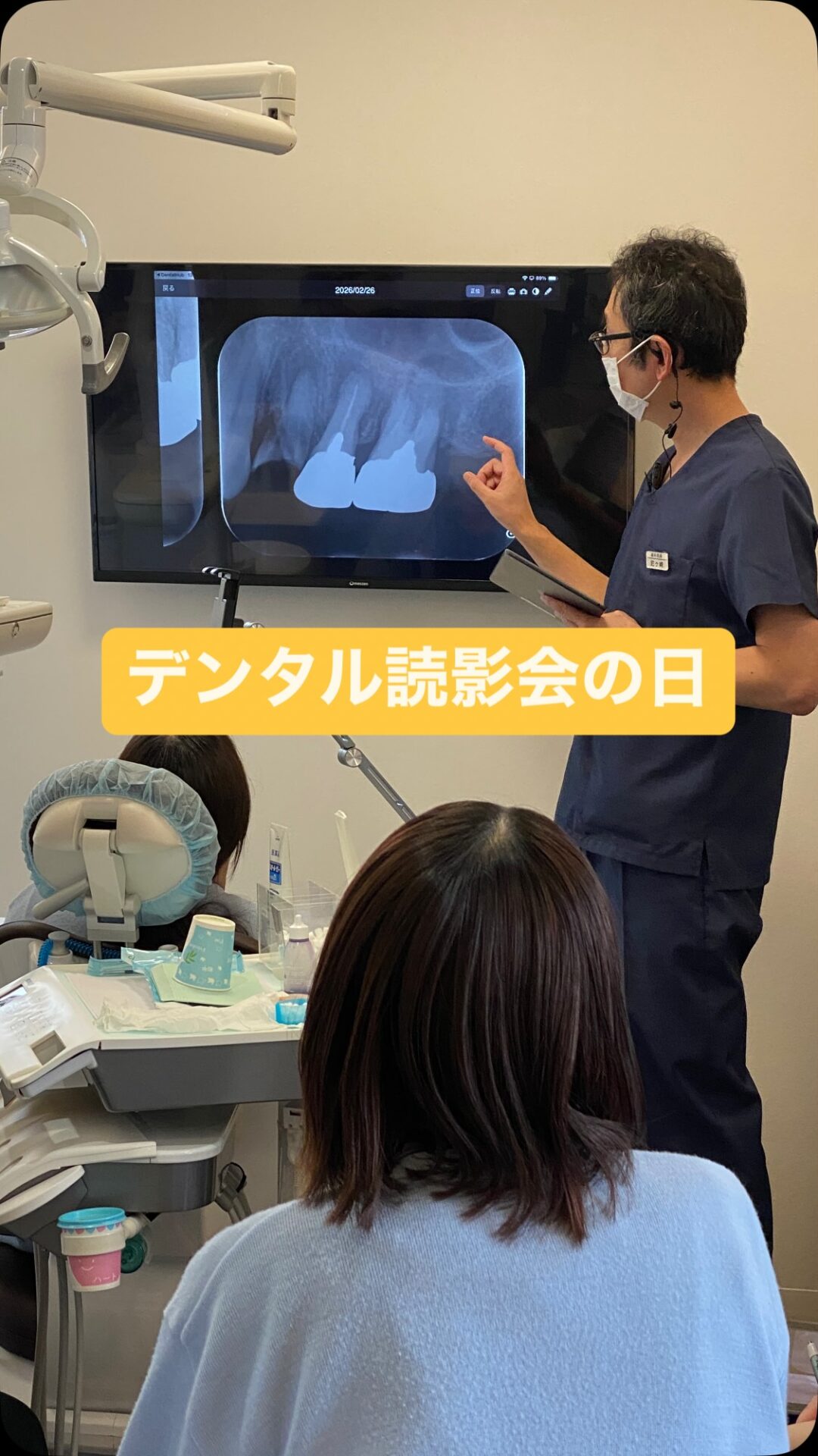 今日はデンタル読影会🦷✨
当院では定期的にデンタル読影会を行い、
診断力・観察力の向上に取り組んでいます💪🏼
みんなでレントゲンを見ながら、意見交換も時には行い、日々の診療に自信を持って臨めるよう、
スタッフ全員で成長できる環境づくりを大切にしています🩻✨
#勉強会
#デンタル読影
#島根歯医者
#歯科衛生士
